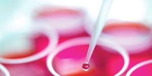 Autologous Stem Cells